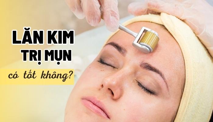 lăn kim trị mụn có tốt không? lăn kim trị mụn có tác dụng gì?