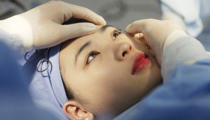 Tổng hợp các loại chỉ phẫu thuật mắt an toàn nhất hiện nay